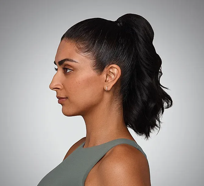 Juvederm Before & After