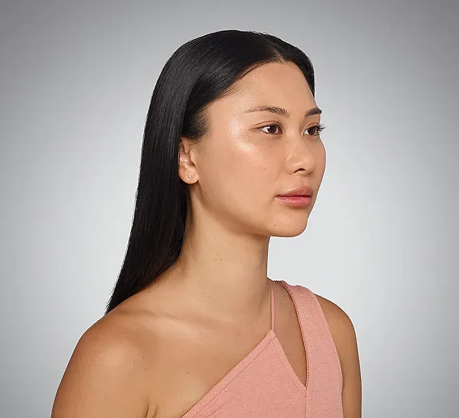 Juvederm Before & After