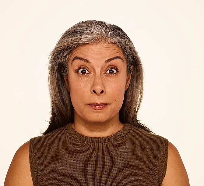 Botox Before & After