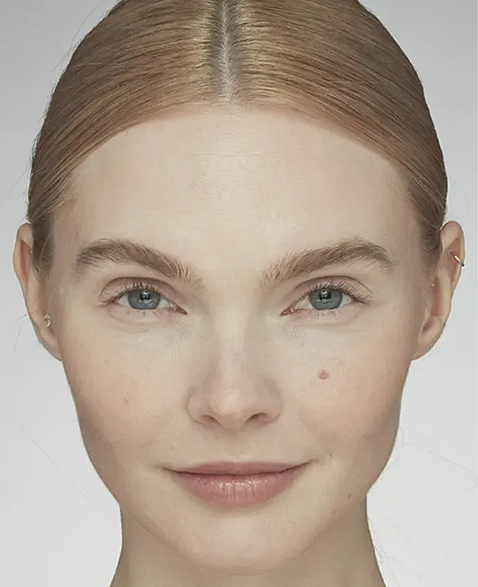 Latisse Before & After